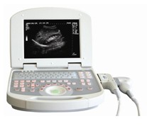 Laptop Ultrasound ,Health & Medical