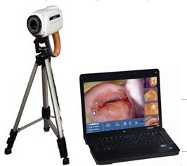 Digital Electronic Colposcope, Microscope